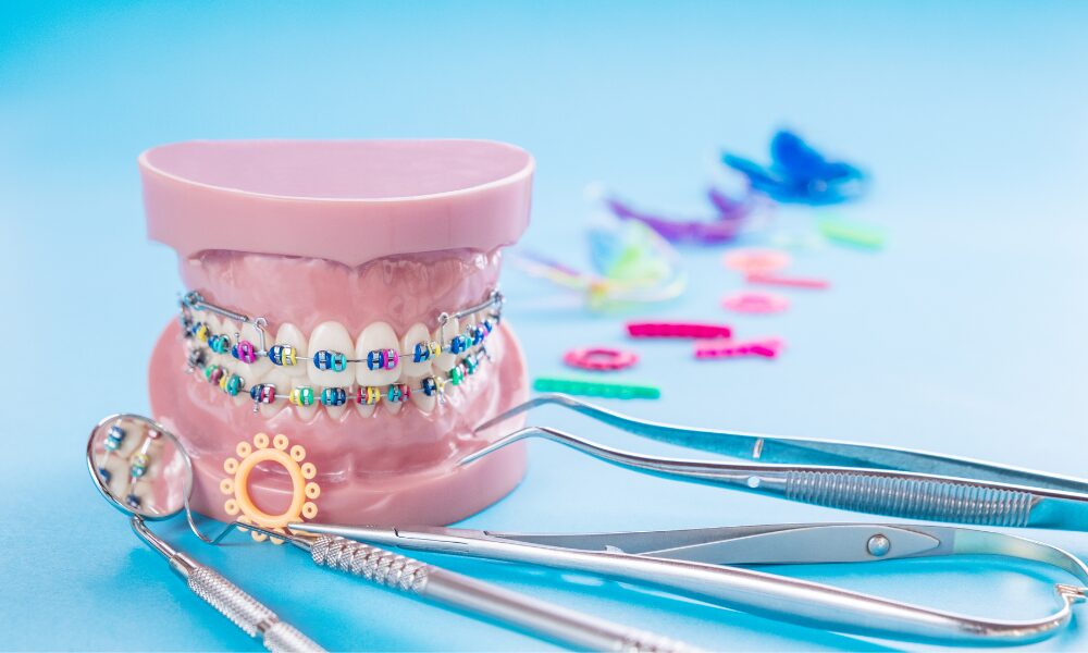 Ortodonti Tedavi Ücretleri